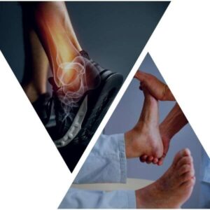 Ankle & Foot Injury attorney| Gaylord & Nantais