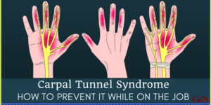 carpal tunnel syndrome | Gaylord & Nantais