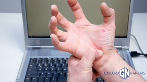 How to Win a Carpal Tunnel Workers' Comp Claim In California | GN