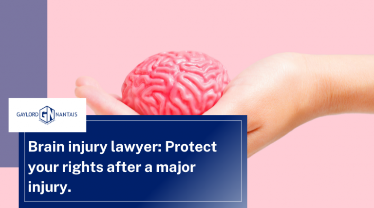 Brain injury lawyer: Protect your rights after a major injury.